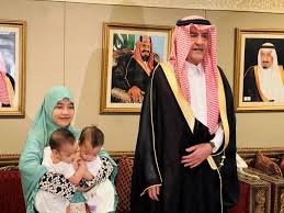 التوأم السيامي الفلبيني عائشة وأكيزا، عائشة وأكيزا ويكيبيديا