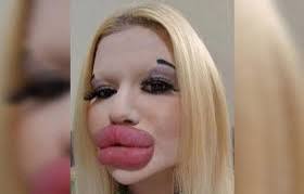 كريستينا راي ويكيبيديا، سبب وفاة كريستينا راي صاحبة أكبر شفاه في العالم